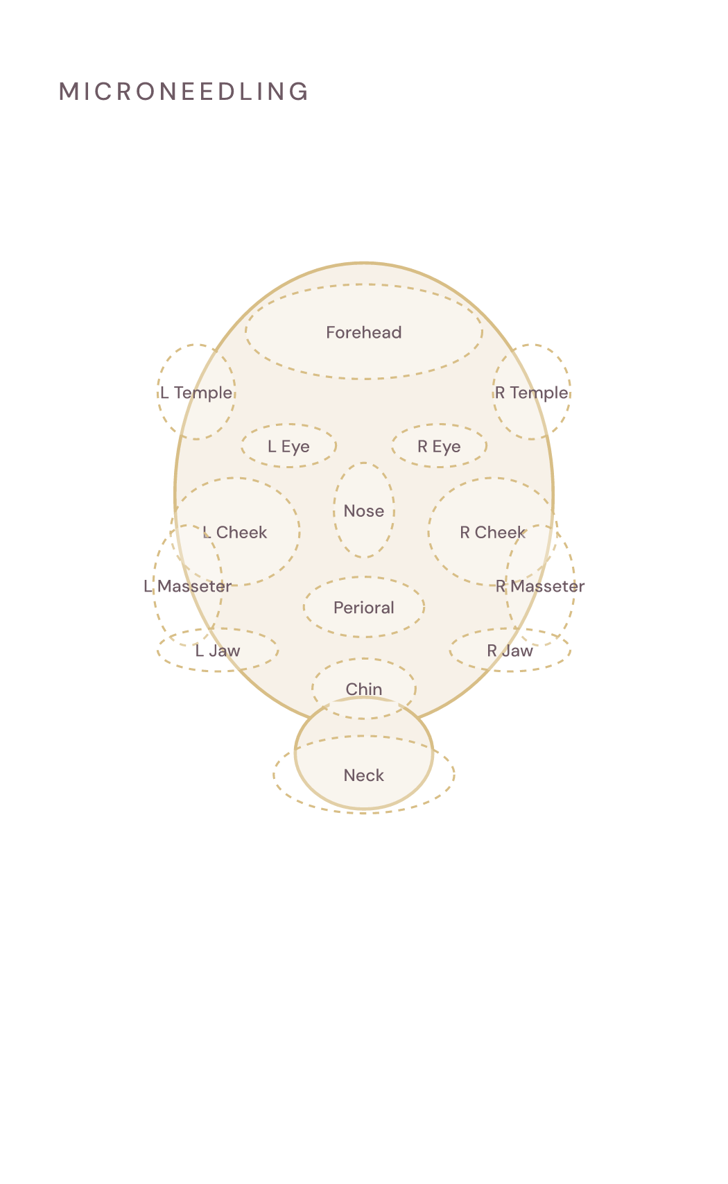 An empty face map with dashed treatment zones, ready for depths